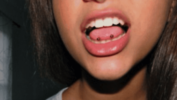 tip tongue piercing