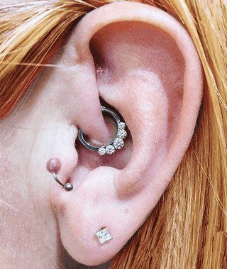 Cartilage Piercing Bumps Causes Treatment and Prevention